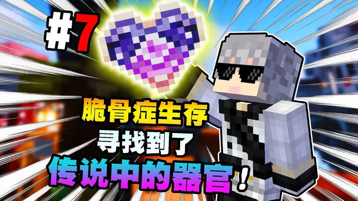 [Living with Osteogenesis Imperfecta] I’ve Found the “Legendary Organ”!!? Episode 7