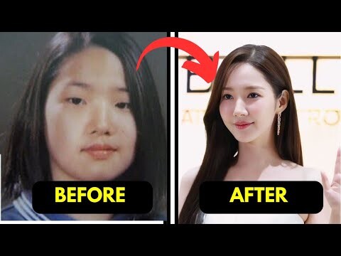 Korean Actors With The Wildest Plastic Surgeries