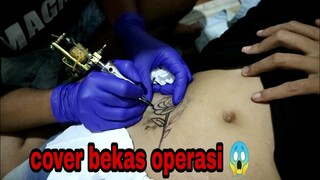 cover up bekas operasi || black and grey tattoo