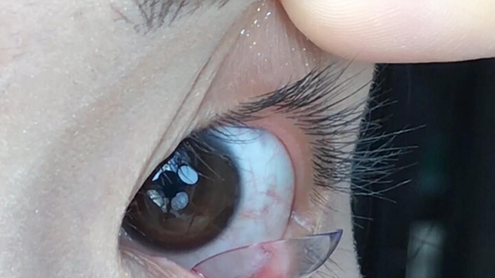 3 طرق سريعة لوضع وإزالة العدسات اللاصقة