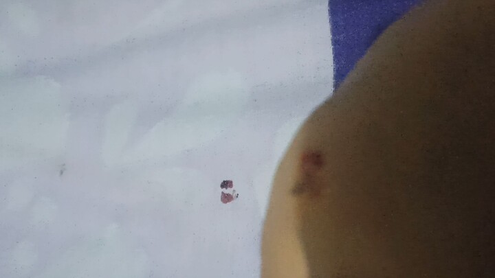 cara membunuh nyamuk dengan benar part3