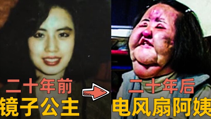 Korean Fan Lady Once More Beautiful Than Wang Zuxian: Facial Injection with Salad Oil, Addicted to P