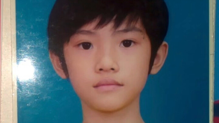 Anak ini sudah punya kantung mata sejak kecil.