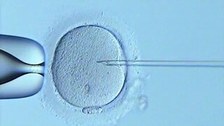 第二代“试管婴儿”：卵胞浆内单精子显微注射技术，一个新生命就这样开始了...