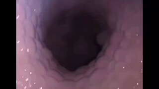 暗网合集【4】（1补）