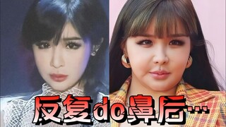 Apa yang terjadi setelah operasi hidung berulang?