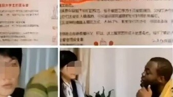 Rumah Sakit Guangxi menganjurkan untuk menjauhi mahasiswa internasional berkulit hitam untuk mencega