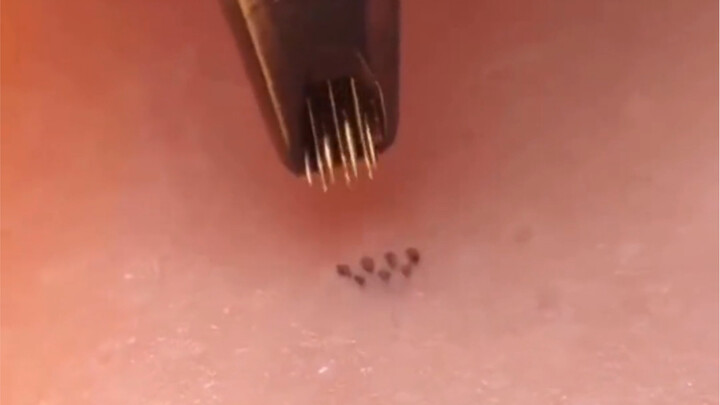 Let's see how your tattoo was done!