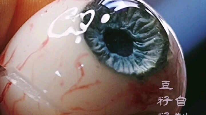 Overused your eyes? Squeeze it out and give it a massage! [DANGEROUS ACTIVITY — DO NOT REPLICATE!]