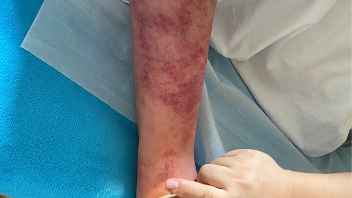 تنشيط القلب والرئتين [ابتسامة مشرقة][ابتسامة مشرقة]