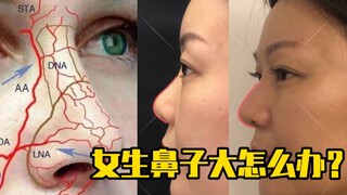 Apa yang harus dilakukan jika hidung perempuan besar?