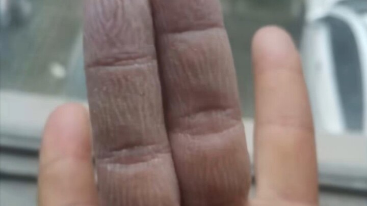 【الصورة المروعة الثالثة】عندما يتحول الذكر إلى أنثى