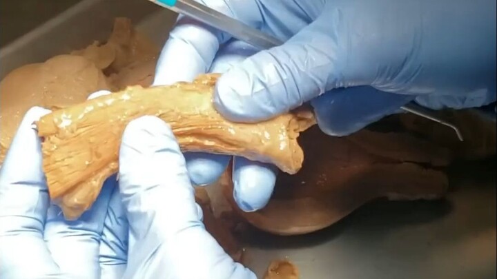 这条扁平的管状结构就是女生的阴道，它是专属于女生的一种特殊结构