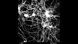 Neuron Connectivity Time Lapse