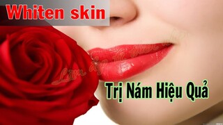 Whiten skin natural cures | Trị Tàng Nhang Hiệu Quả |Làm Đẹp Từ Thiên Nhiên #36