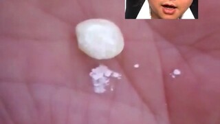 นี่ไม่ได้พิลึกไปกว่าลิงน้ำเหรอ?