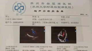 这个病症比较严重 但是靠BUG又弥补了这一问题