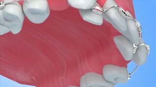 Dental an Corrective Jaw Surgery