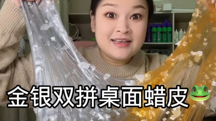 My dear, you're definitely healthy and bound to strike it rich!