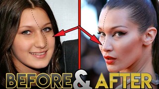 ใช่หรือไม่ว่าเธอขึ้นสู่จุดสูงสุดด้วยการศัลยกรรมจริงๆ? การเปรียบเทียบความแตกต่างก่อนและหลังของเบลลา ฮ