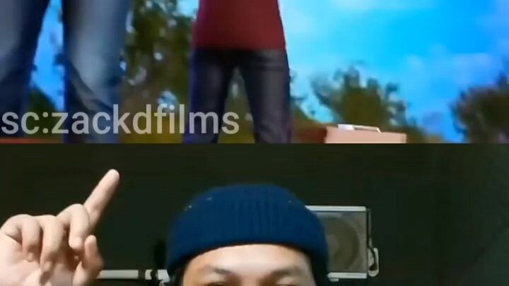 bibirnya terkena kail pancing😮