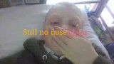 Nose bleed pt 2