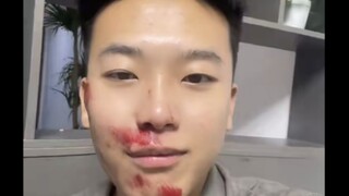 狂笑不止！江苏两名男大骑电动车时不慎摔倒，两人一个去找鞋、一个去找手机，其中一名男生更是冲着另一名男生大笑不止，网友：原本挺揪心的，看他笑那么大声也忍不住想笑