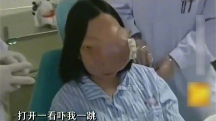 Cheerful Commentary – A teenage girl with a “horse face” covers her head every day when she goes out
