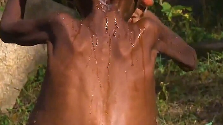 The boy's abdomen was infected by an unknown parasitic creature, and his mother was worried and live
