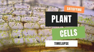 Reduce Anxiety & Stress, Satisfying Plant Cells Under Microscope Timelapse #timelapse #calm #shorts