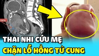 💥Thai nhi XOAY MÌNH BỊT LỖ HỔNG TỬ CUNG cứu sống mẹ khiến bác sĩ ngỡ ngàng | TIN GIẢI TRÍ