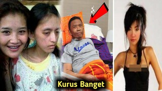 Tubuh 6 Artis Nyaris Tinggal Kulit dan Tulang Sebelum Meninggal Dunia