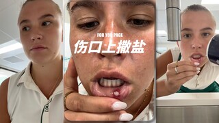 รู้สึกเจ็บมากแม้จะอยู่แค่ฝั่งหน้าจอเท่านั้น 🤯