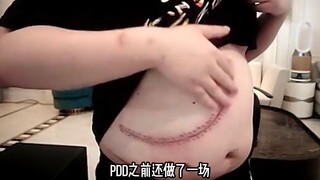 หน้า PDD กระตุกหลังไลฟ์สด 15 ชม. สงสัยเป็นอัมพาตใบหน้า