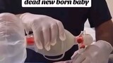 Miracle in healthcare. Video not mine. Credits to @SheNurseSavvy