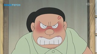 Doraemon episode 304