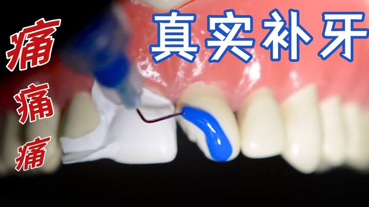 It Already Hurts! First-Person Science: How a Dentist Fixes Your Tooth