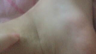 77
