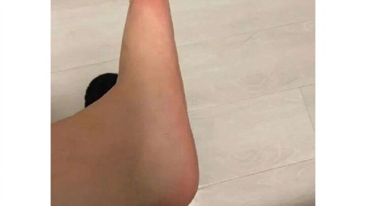 Do I really have flat feet?