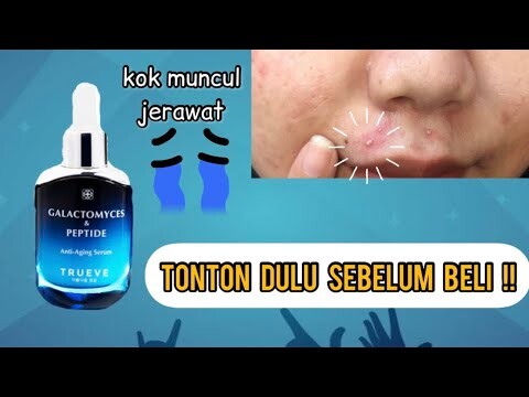 REVIEW JUJUR SERUM ANTI AGING TRUEVE