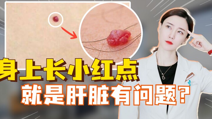 Do small red spots on your body mean there's a liver problem?
