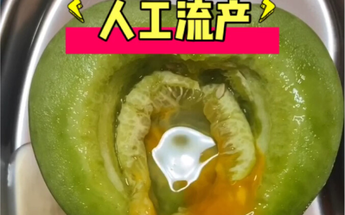 แพทย์ ICU "ลงมือ" สาธิต: การทำแท้งด้วยวิธีเทียม!