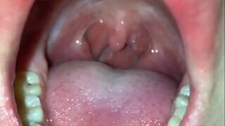 keluar dimulut ditelan sampe nangis