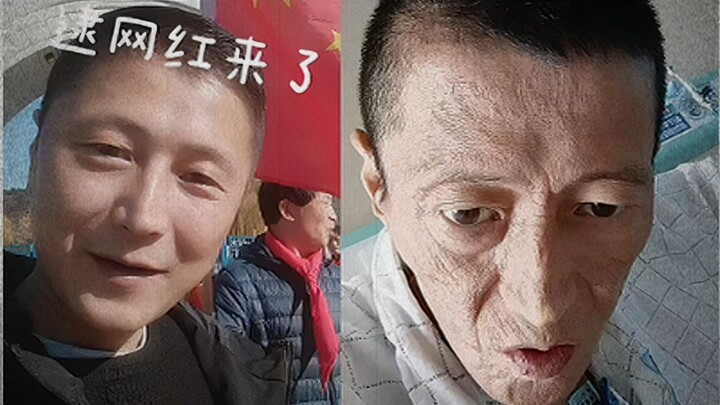 What lengths cancer can drive a person to—Jiang Xiaoyu is a testament to the human spirit.
