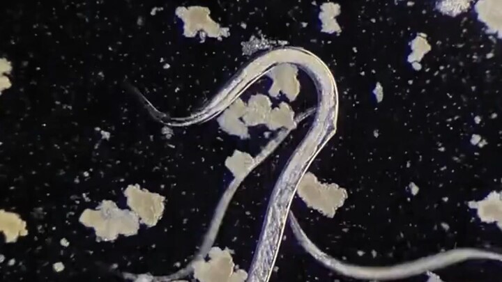 stop eat egg until you watch this video under microscope you won't believe it under 400x zoom 🙀🔬
