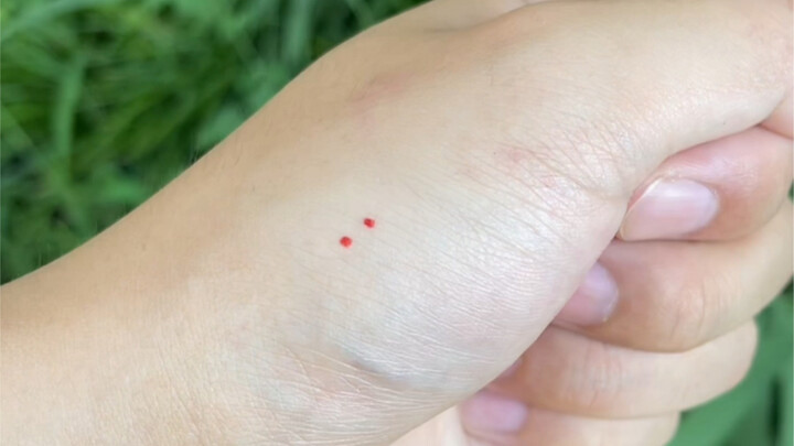 إذا لُدِغتَ من هذا النوع من الثعابين، أي قسم تزور؟!