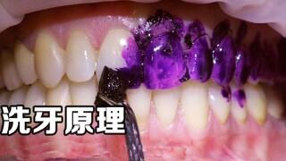 专业人士讲解：洗牙是如何完成的