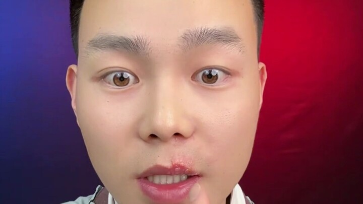 ไม่ใช่ร้อนใน! แต่เป็นพิษแล้ว🤢