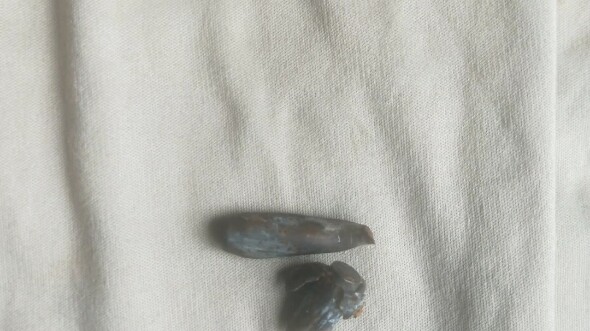 หัวกระสุนที่ถูกนำออกมาจากเถ้ากระดูกของคุณปู่...ตอนมีชีวิตอยู่เคยร่วมรบในสงครามเวียดนามด้วย!