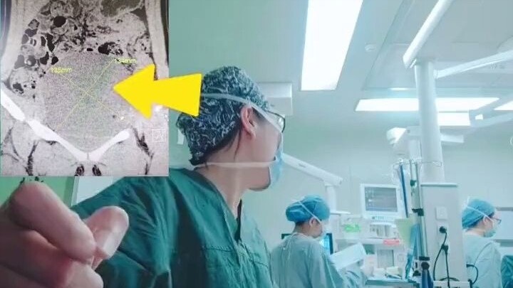 When the doctor learned that the patient's tumor was benign